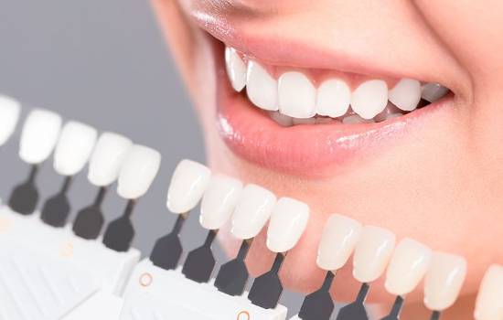 Estética Dental