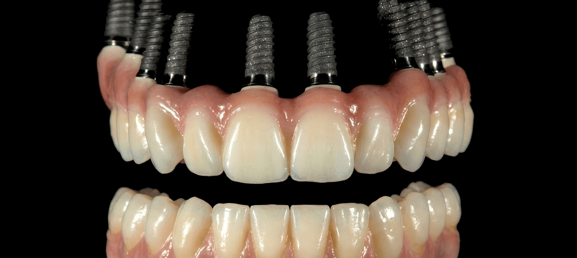 Fixed zirconia implants